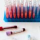 Analize de rutina pentru sanatate preventiva